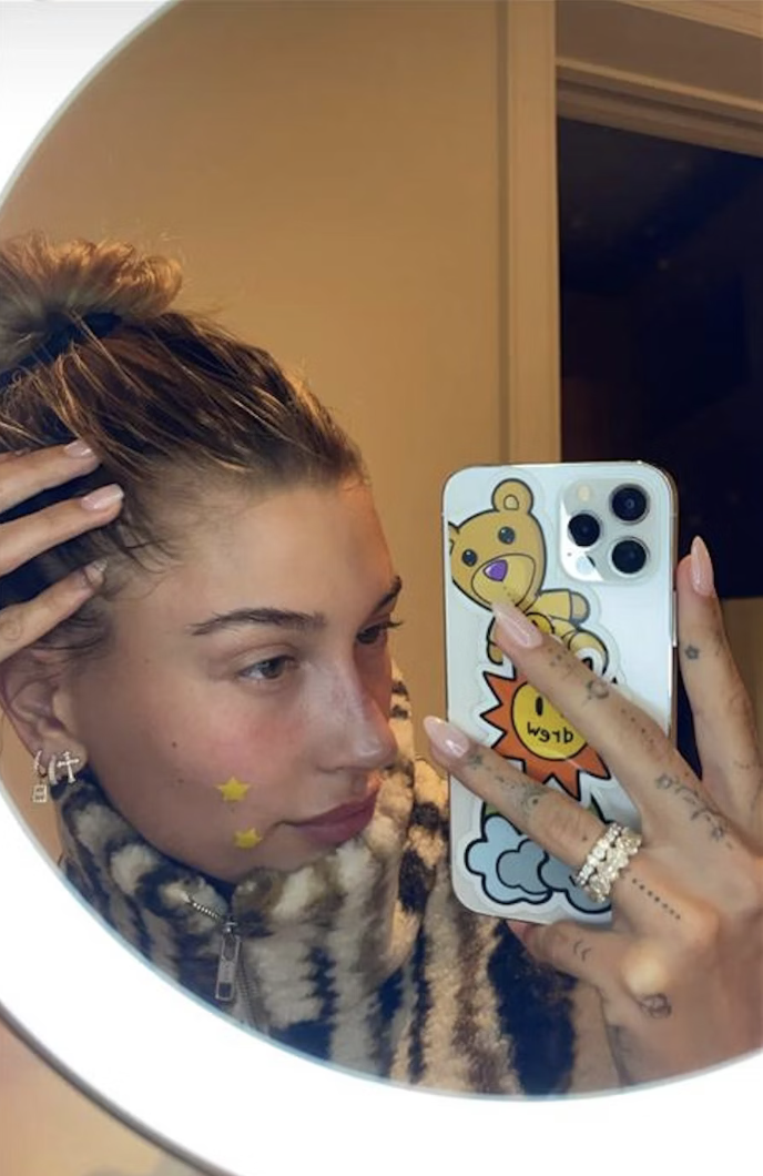 stickers om je pukkels in de nacht te laten verdwijnen-2