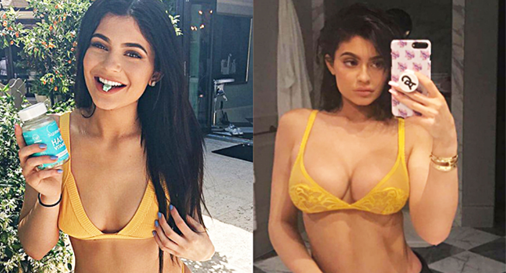 Kylie Jenner cosmetische ingrepen spijt