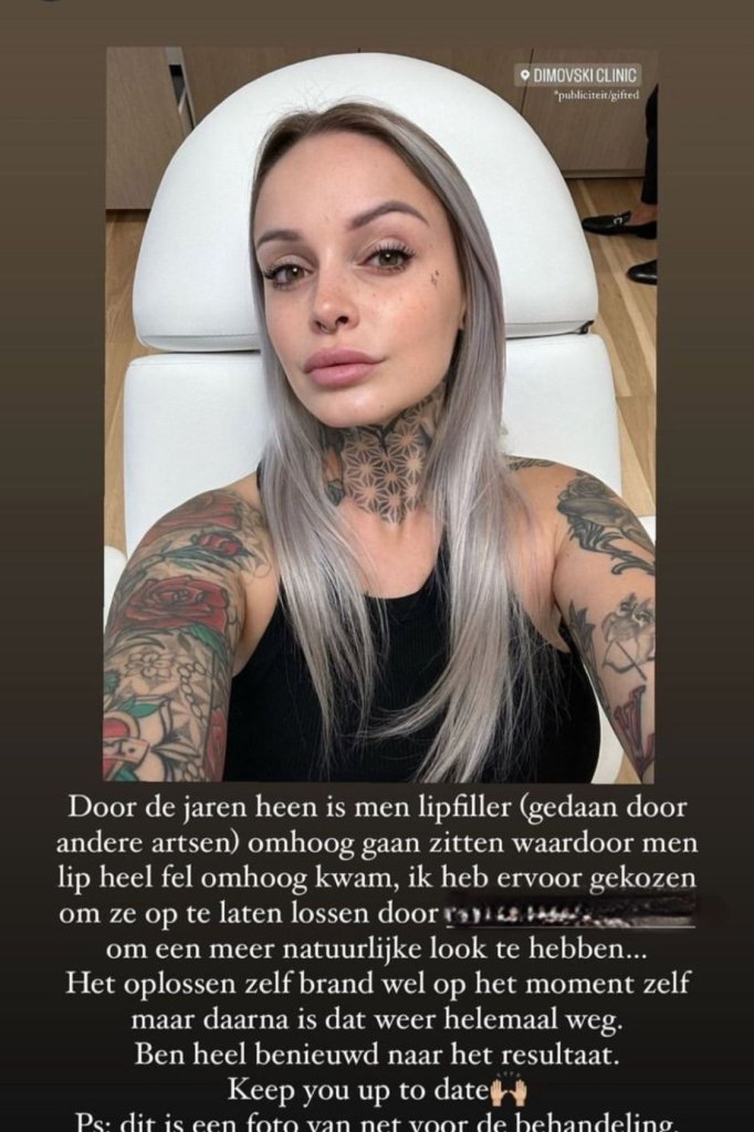 Pommeline Tillière lipfillers